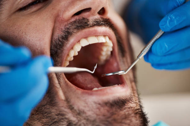 Emergency Dental Services in Richmond Heights, MO